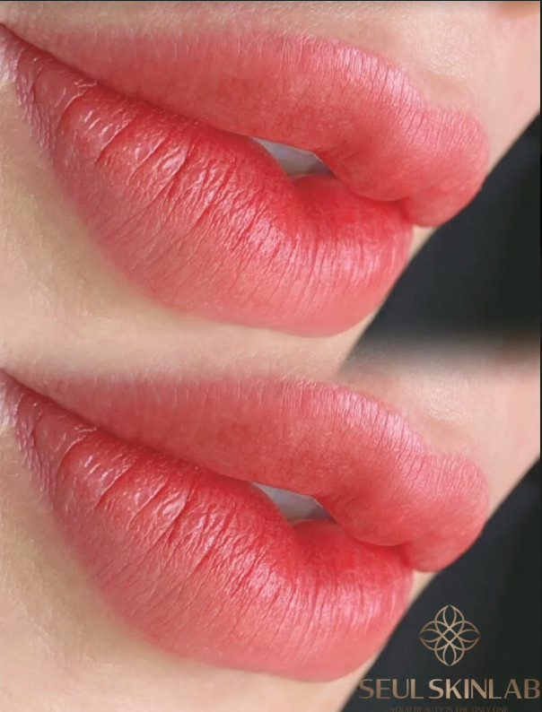 Phun môi Nano Collagen Candy Lips