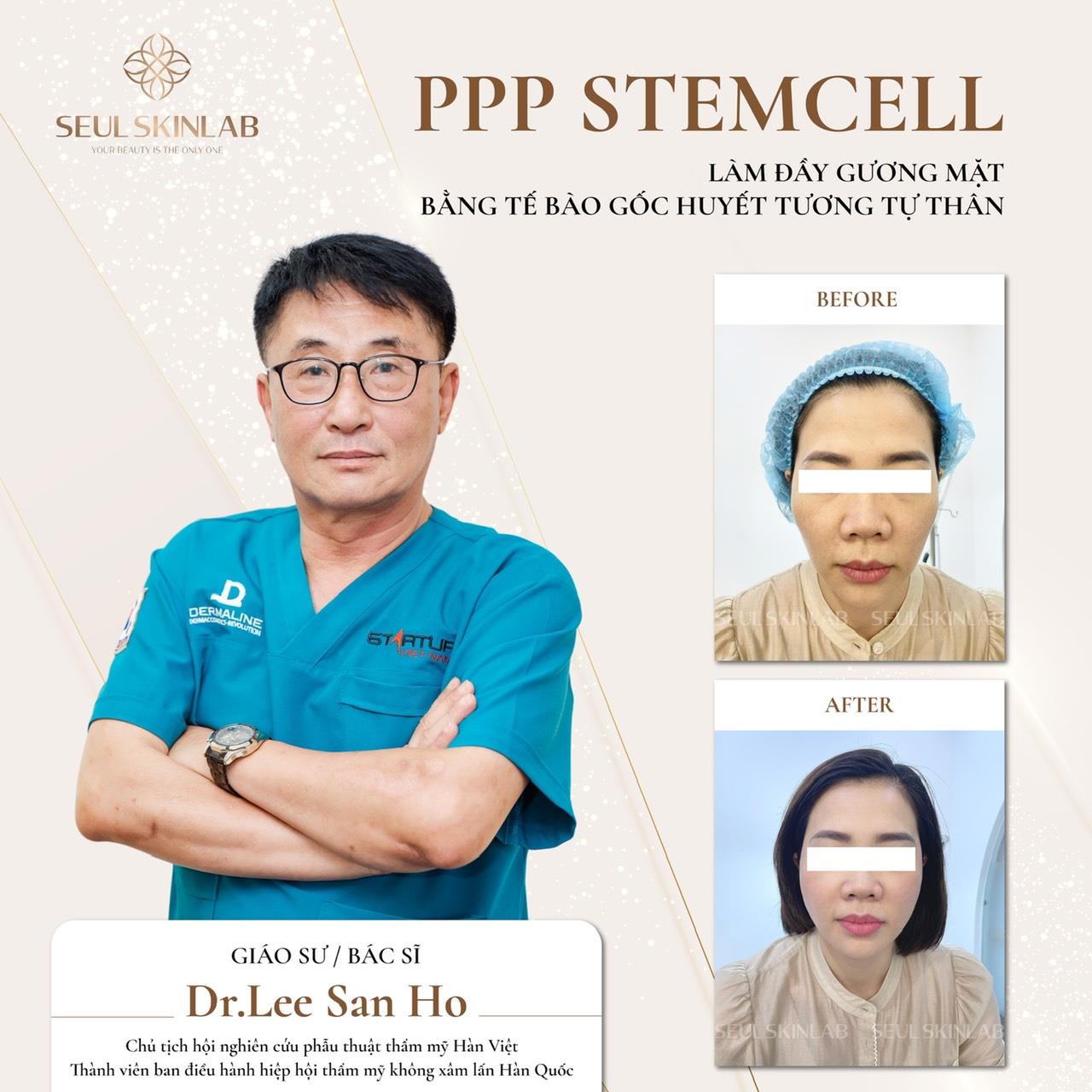 PPP Stemcell Thái Dương - Bs Hàn
